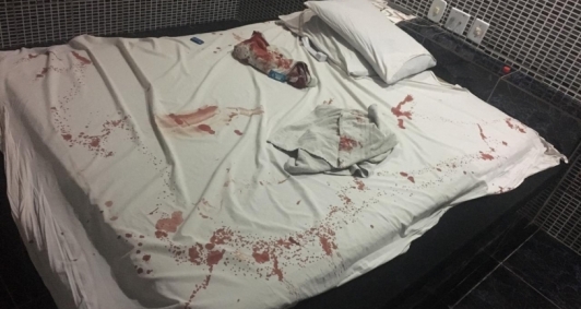 Marcas de sangue dentro de quarto de motel na BR 101, no Parque Boa Vista, em Guarus