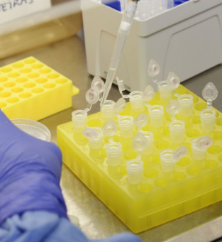 Diagnóstico laboratorial de casos suspeitos do novo coronavírus 