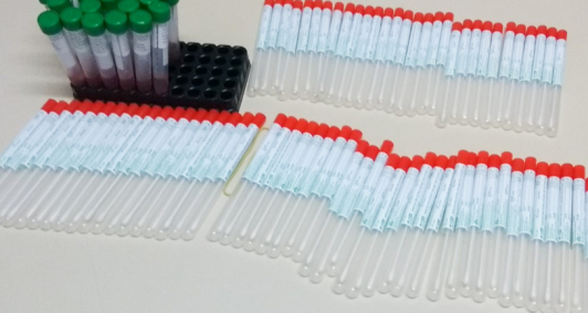 Testes r&aacute;pidos para detectar coronav&iacute;rus