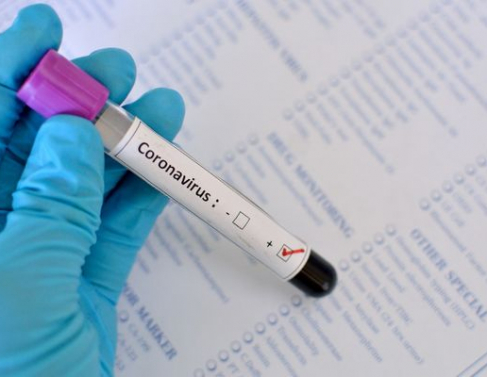 Teste coronavírus