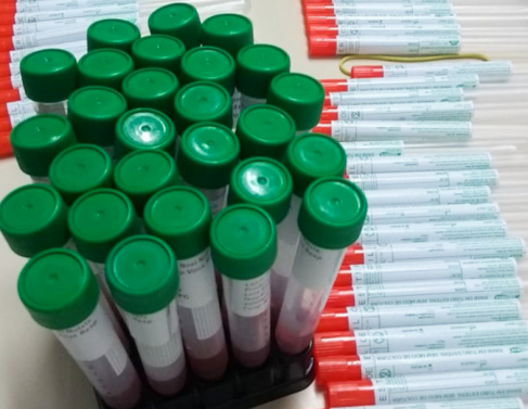 Testes de coronav�rus