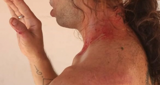 Guilherme mostrou agresses (Fotos: Reproduo Instagram)