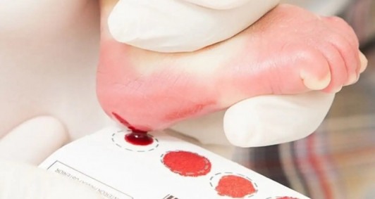 O Dia Nacional da Triagem Neonatal, também conhecido como teste do pezinho é comemorado nesta quinta-feira (6) - Foto: Agência Brasil 