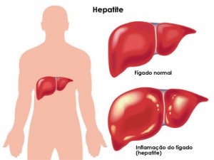 hepatite-resumo