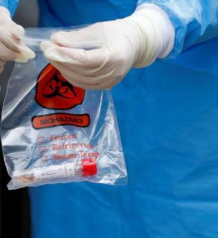 testes de coronav&iacute;rus 