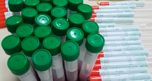 Testes de coronavírus