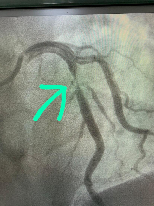 Antes da interven&ccedil;&atilde;o