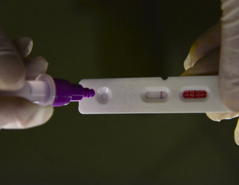 Teste R&aacute;pido Ant&iacute;geno para Covid-19