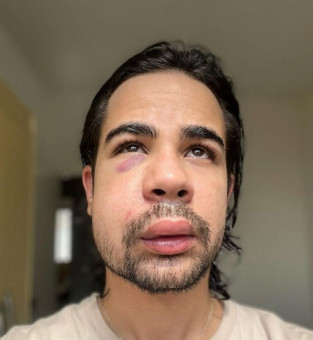 Fotografo denuncia agressão em Campos