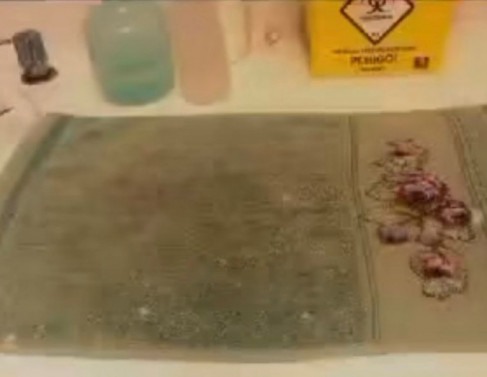 Vigilância diz que encontrou grave falta de higiene 